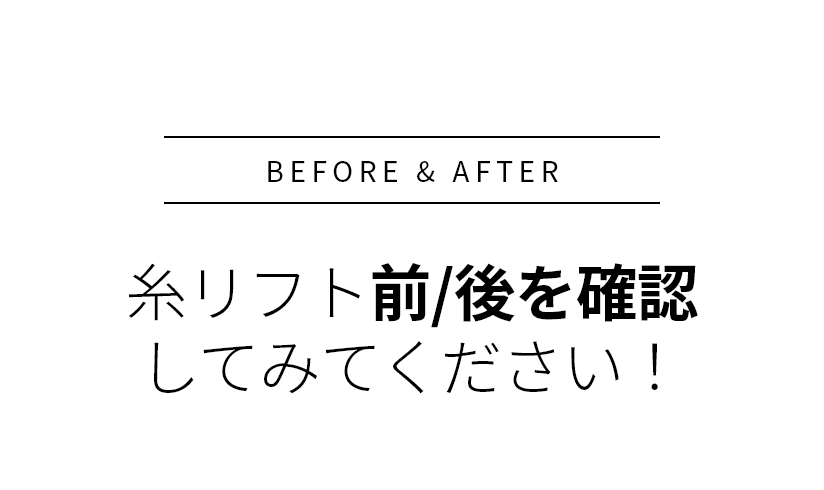 BEFORE & AFTER 픽업 내시경이마거상술 전/ 후를 확인해보세요!