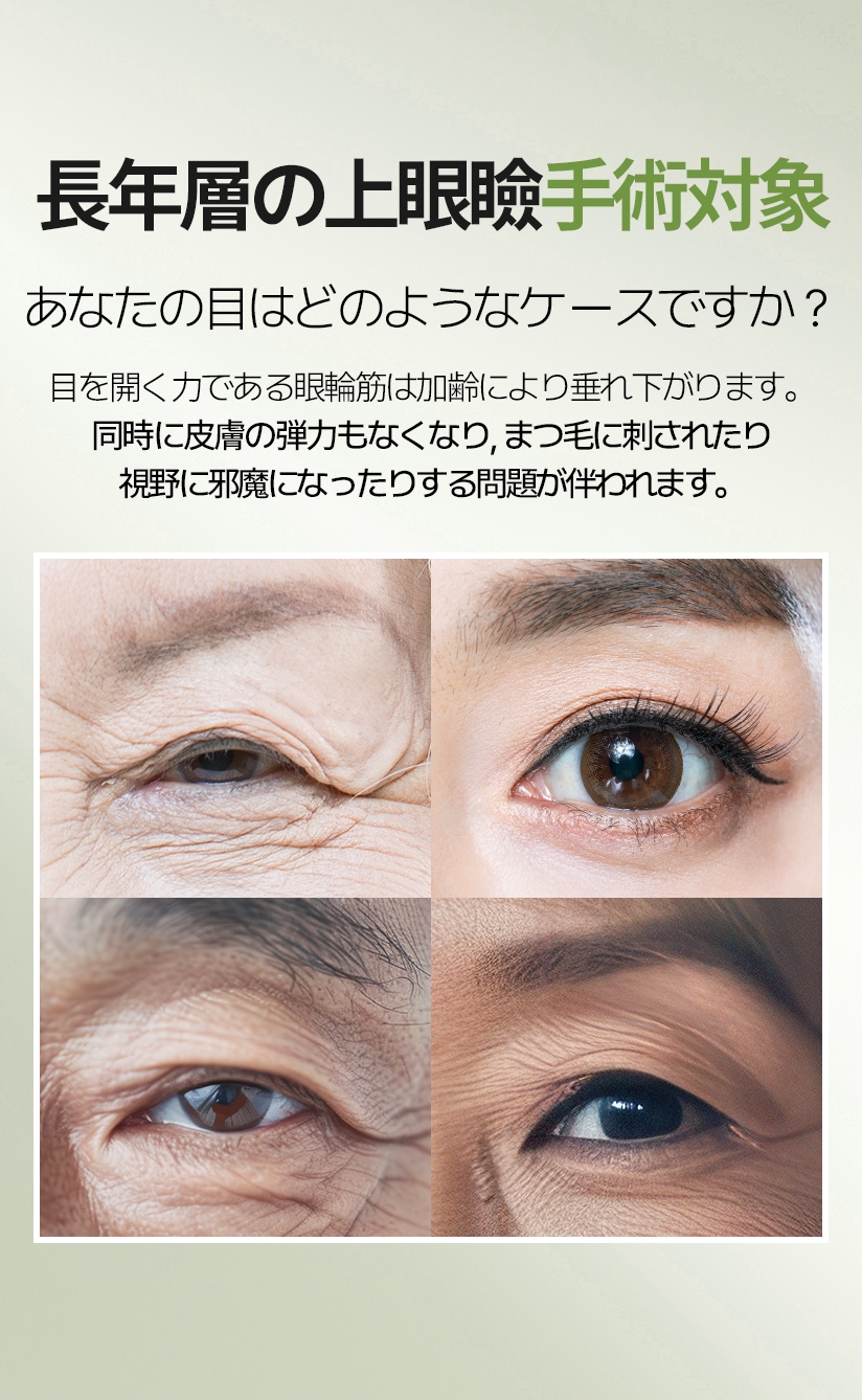 長年層の上眼瞼手術対象 あなたの目はどのようなケースですか? 目を開く力である眼輪筋は加齢により垂れ下がります。 同時に皮膚の弾力もなくなり, まつ毛に刺されたり視野に邪魔になったりする問題が伴われます。