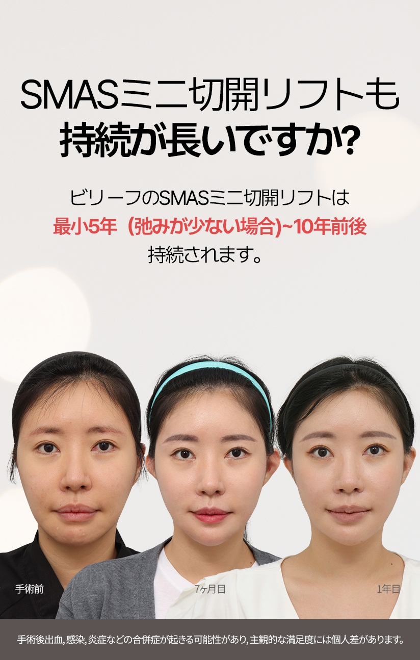 SMASミニ切開リフトも 持続が長いですか？ ビリーフのSMASミニ切開リフトは 最小5年（弛みが少ない場合)~10年前後 持続されます。手術後出血, 感染, 炎症などの合併症が起きる可能性があり, 主観的な満足度には個人差があります。