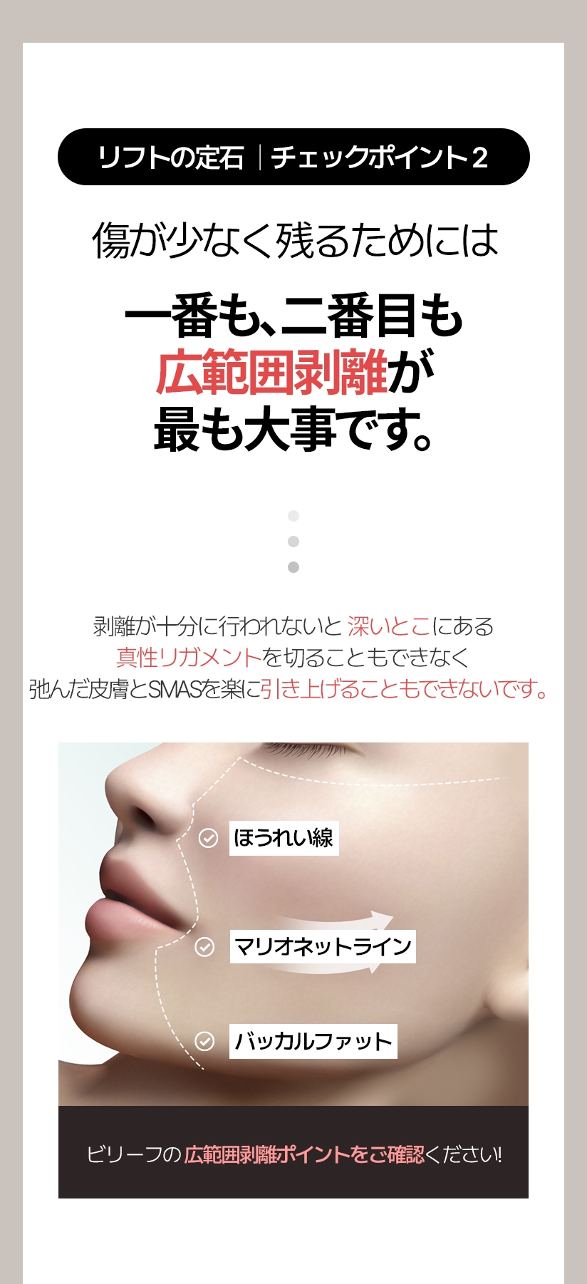 リフトの定石  |  チェックポイント2 傷が少なく残るためには 一番も、二番目も広範囲剥離が 最も大事です。剥離が十分に行われないと深いとこにある真性リガメントを切ることもできなく 弛んだ皮膚とSMASを楽に引き上げることもできないです。ほうれい線 マリオネットライン バッカルファット ビリーフの 広範囲剥離ポイントをご確認ください! 