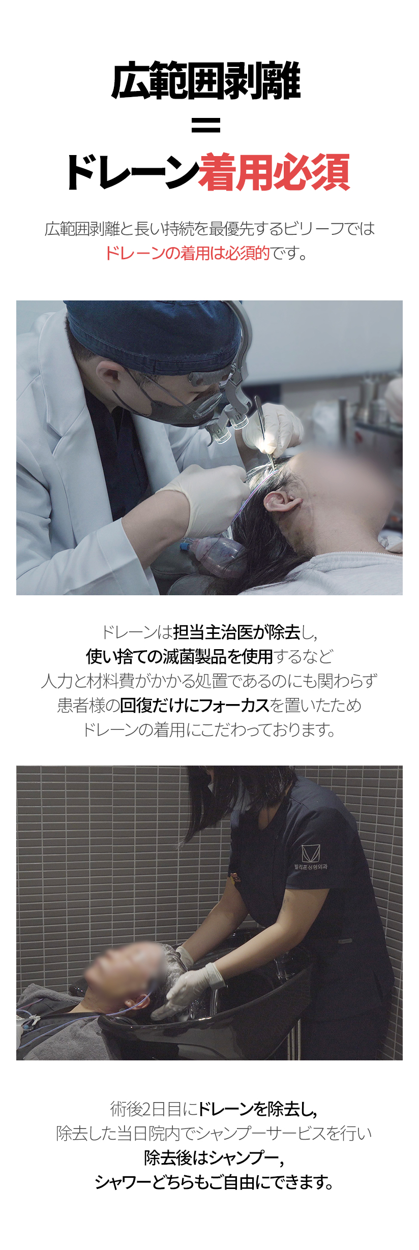 広範囲剥離＝ドレーン着用必須 広範囲剥離と長い持続を最優先するビリーフでは ドレーンの着用は必須的です。ドレーンは担当主治医が除去し, 使い捨ての滅菌製品を使用するなど 人力と材料費がかかる処置であるのにも関わらず患者様の回復だけにフォーカスを置いたため ドレーンの着用にこだわっております。術後2日目にドレーンを除去し, 除去した当日院内でシャンプーサービスを行い 除去後はシャンプー, シャワーどちらもご自由にできます。