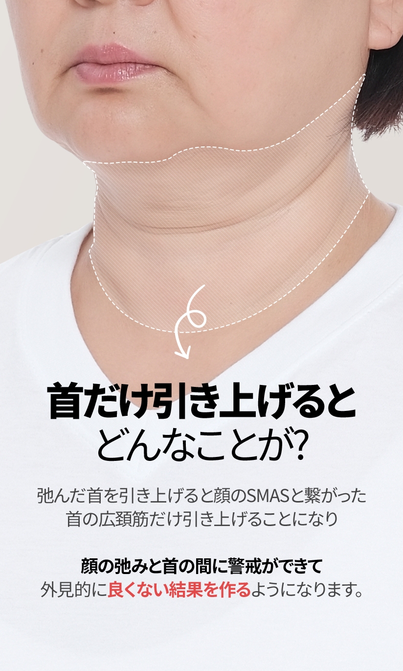 首だけ引き上げると どんなことが？ 弛んだ首を引き上げると 顔のSMASと繋がった 首の広頚筋だけ引き上げることになり 顔の弛みと首の間に警戒ができて 外見的に良くない結果を 作るようになります。