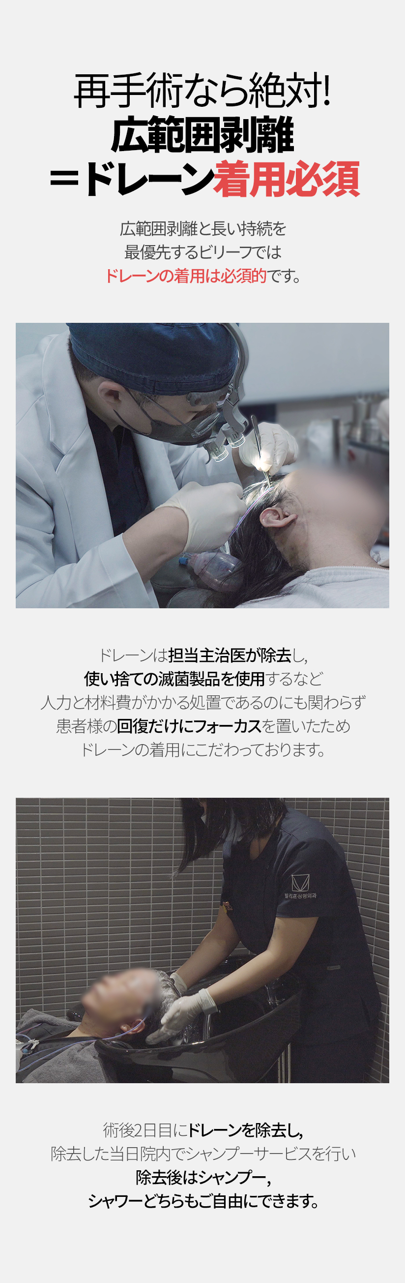 再手術なら絶対！ 広範囲剥離 ＝ドレーン着用必須 ドレーンは担当主治医が除去し, 使い捨ての滅菌製品を使用するなど 人力と材料費がかかる処置であるのにも関わらず患者様の回復だけにフォーカスを置いたため ドレーンの着用にこだわっております。術後2日目にドレーンを除去し, 除去した当日院内でシャンプーサービスを行い 除去後はシャンプー, シャワーどちらもご自由にできます。