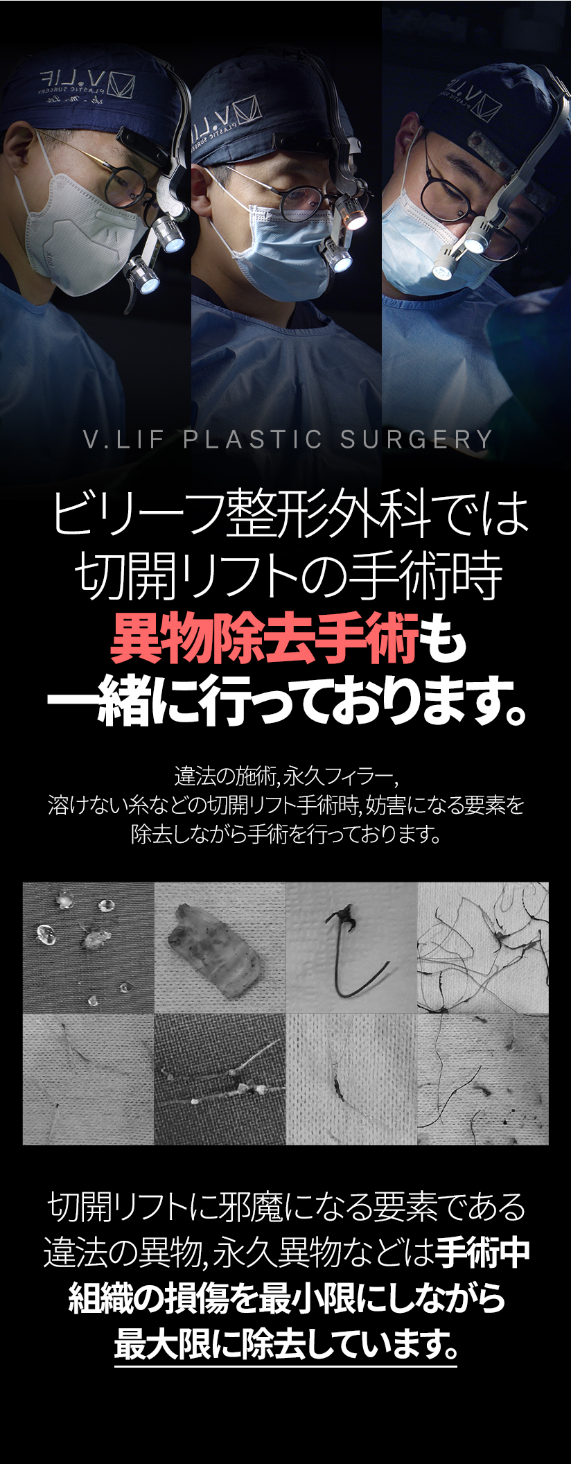 ビリーフ整形外科では切開リフトの手術時 異物除去手術も 一緒に行っております。違法の施術, 永久フィラー, 溶けない糸などの切開リフト手術時, 妨害になる要素を 除去しながら手術を行っております。切開リフトに邪魔になる要素である 違法の異物, 永久異物などは手術中 組織の損傷を最小限にしながら最大限に除去しています。