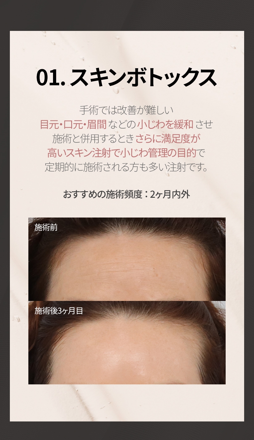 01. スキンボトックス 手術では改善が難しい 目元・口元・眉間 などの 小じわを緩和 させ 施術と併用するとき さらに満足度が 高いスキン注射で小じわ管理の目的で 定期的に施術される方も多い注射です。 おすすめの施術頻度 ： 2ヶ月内外