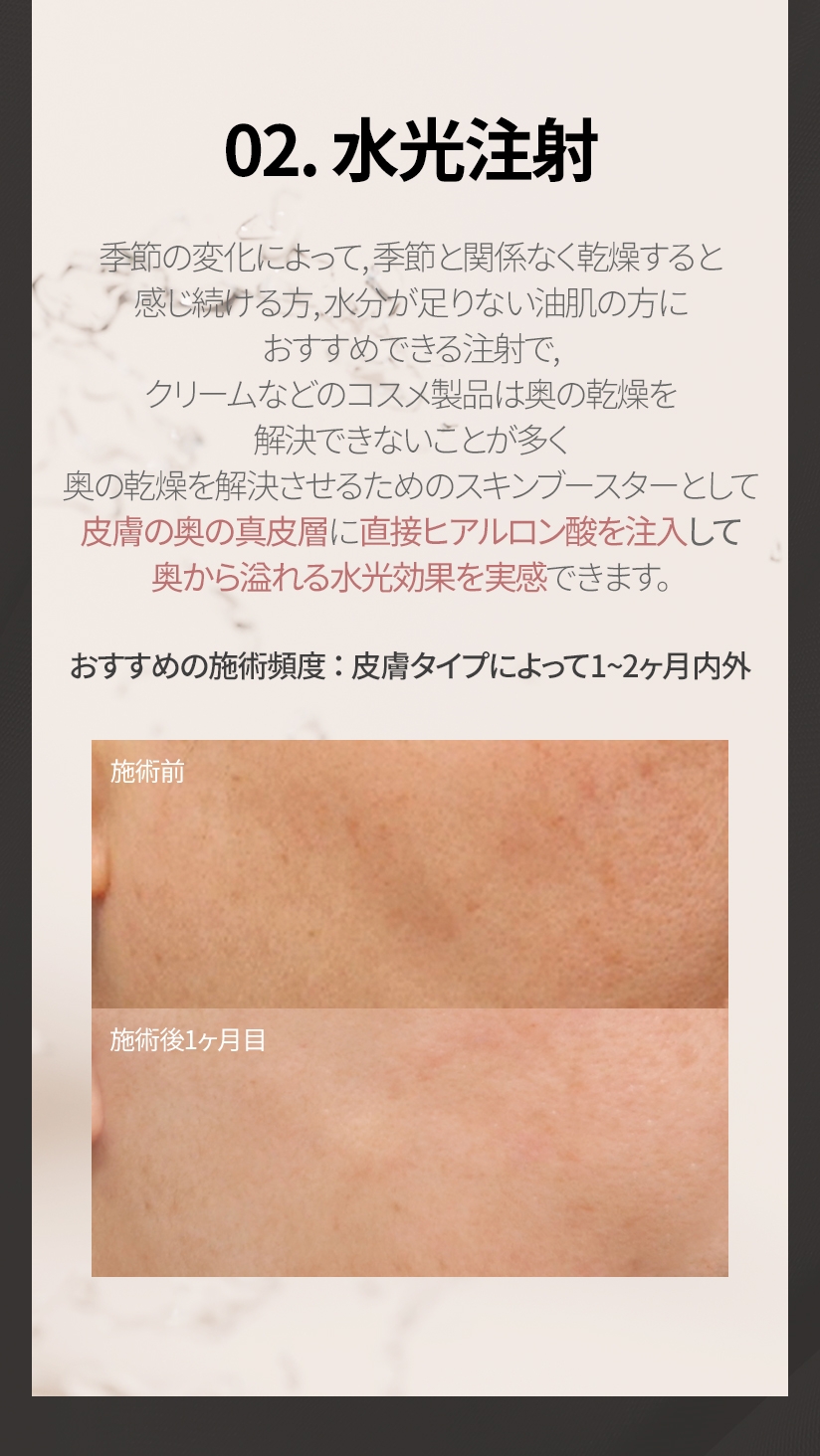 02. 水光注射 季節の変化によって, 季節と関係なく乾燥すると 感じ続ける方, 水分が足りない油肌の方に おすすめできる注射で, クリームなどの コスメ製品は奥の乾燥を解決で きないことが多く奥の乾燥を解決させるための スキンブースターとして皮膚の奥の真皮層に 直接ヒアルロン酸を注入して 奥から溢れる水光効果を実感できます。 おすすめの施術頻度 ： 皮膚タイプによって 1~2ヶ月内外