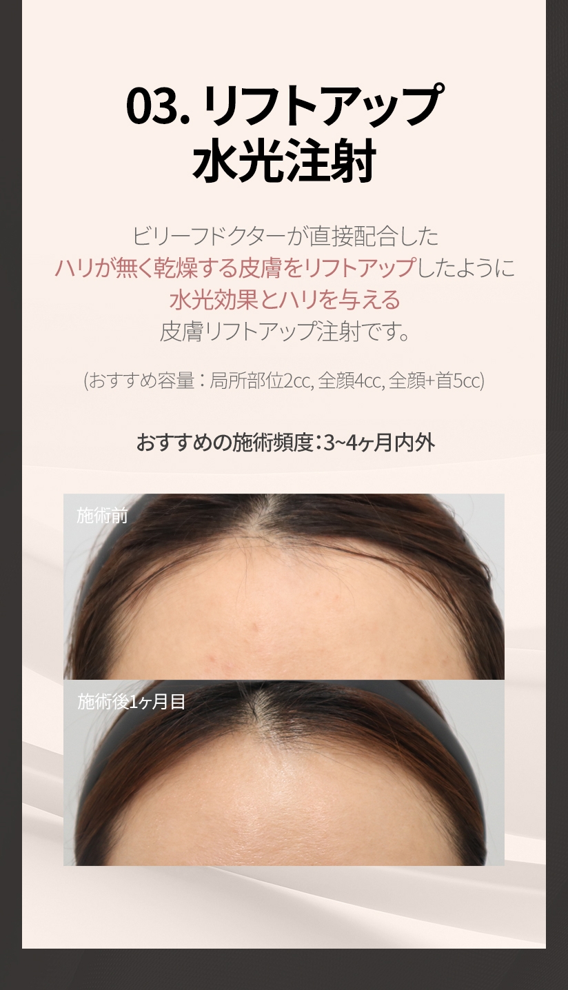 03. リフトアップ 水光注射 ビリーフドクターが直接配合した ハリが無く乾燥する皮膚を リフトアップしたように水光効果とハリを与える皮膚リフトアップ注射です。 (おすすめ容量 ： 局所部位2cc, 全顔4cc, 全顔 + 首5cc) おすすめの施術頻度 ： 3~4ヶ月内外