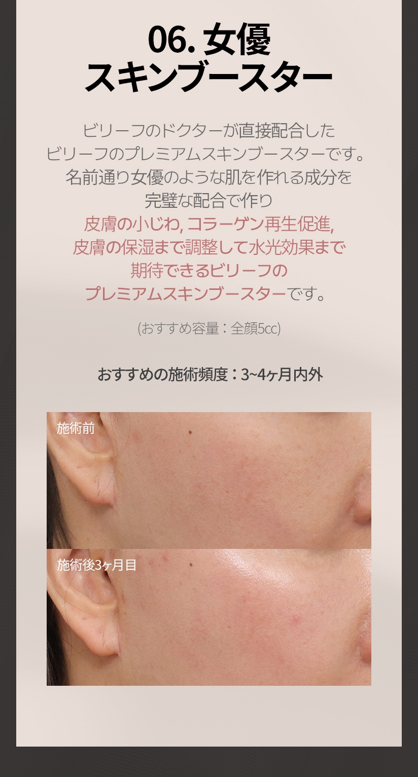 06. 女優 スキンブースター ビリーフのドクターが直接配合した ビリーフのプレミアムスキンブースターです。 名前通り女優のような肌を作れる成分を 完璧な配合で作り 皮膚の小じわ, コラーゲン再生促進, 皮膚の保湿まで調整して水光効果まで 期待できるビリーフの プレミアムスキンブースターです。(おすすめ容量 ： 全顔5cc) おすすめの施術頻度 ： 3~4ヶ月内外 