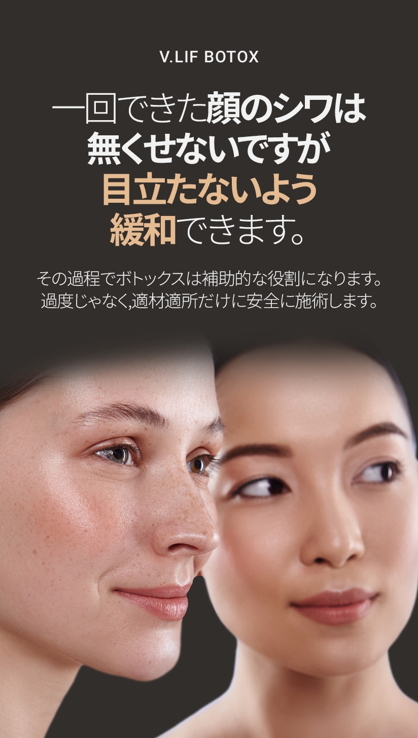 V.LIF BOTOX 一回できた顔のシワは 無くせないですが 目立たないよう 緩和できます。その過程でボトックスは 補助的な役割になります。 過度じゃなく, 適材適所だけに安全に施術します。 