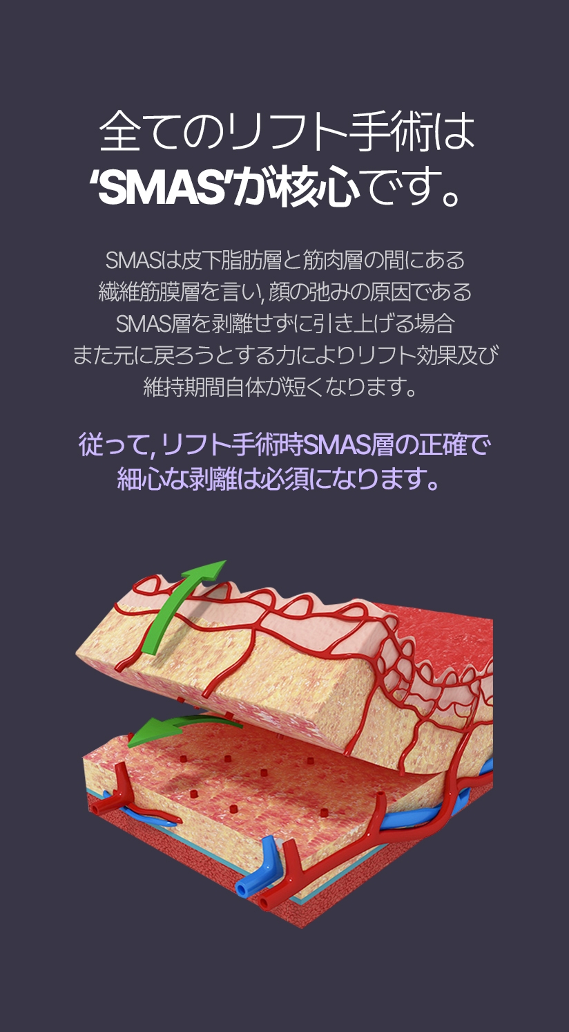 모든 리프팅 수술은 ‘스마스’가 핵심입니다. 스마스는 피하지방층과 근육층 사이에 있는 섬유근막층을 말하며 얼굴 처짐의 원인인 스마스층을 박리하지 않고 당길 경우 다시 되돌아가려는 힘으로 인해 리프팅 효과 및 유지기간 자체가 떨어지게 됩니다. 따라서, 리프팅수술 시 스마스층의 정확하고 세심한 박리는 필수입니다.