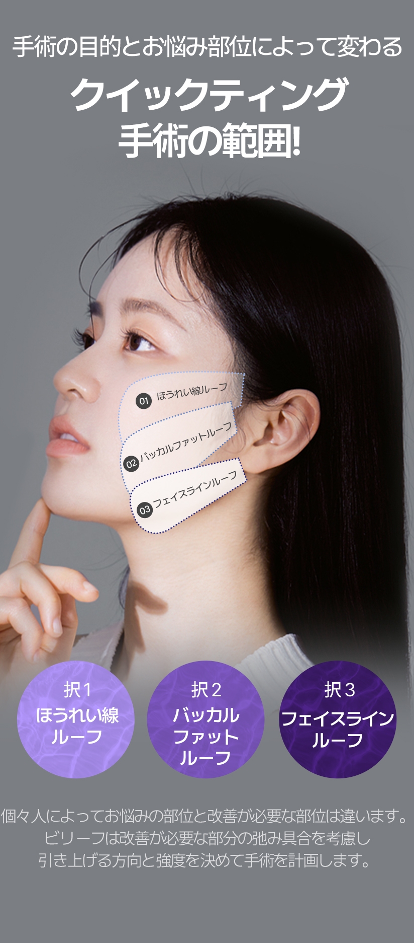 수술 목적과 원하는 부위에 따라 달라지는 퀵프팅 수술의 범위! 택1 팔자라인 루프, 택2 심부볼 라인 루프, 택3 턱라인 루프 개개인마다 고민인 부분과 개선이 필요한 부위는 다릅니다. 빌리프는 개선이 필요한 부분의 처지고 늘어진 정도를 고려하여 당기는 방향과 강도를 결정하여 수술을 계획합니다.